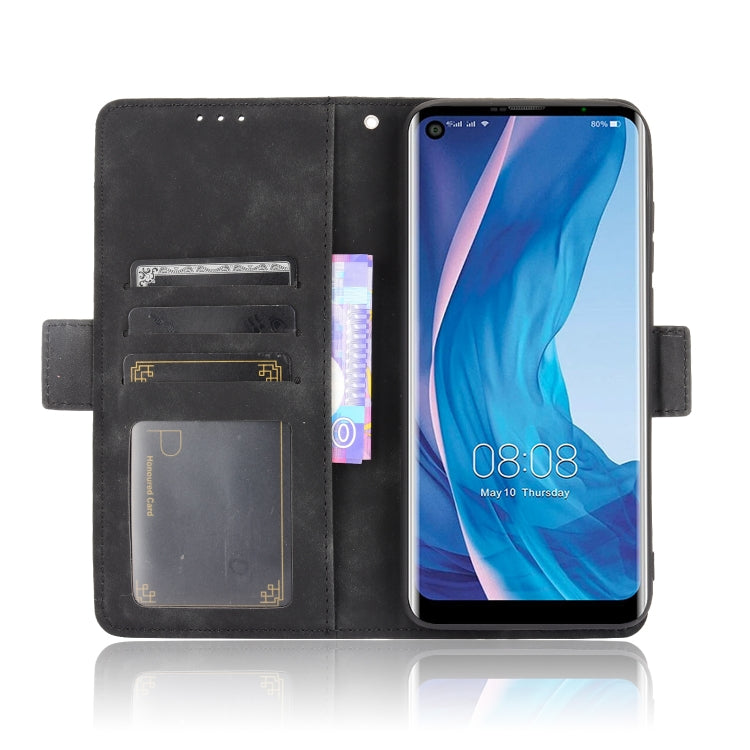 For Ulefone Note 11P Skin Feel Calf Pattern Horizontal Flip Leather Case with Holder & Card Slots & Photo Frame(Black)