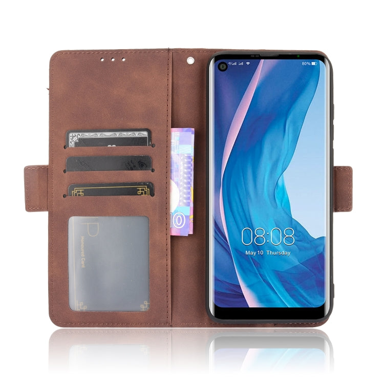 For Ulefone Note 11P Skin Feel Calf Pattern Horizontal Flip Leather Case with Holder & Card Slots & Photo Frame(Brown)