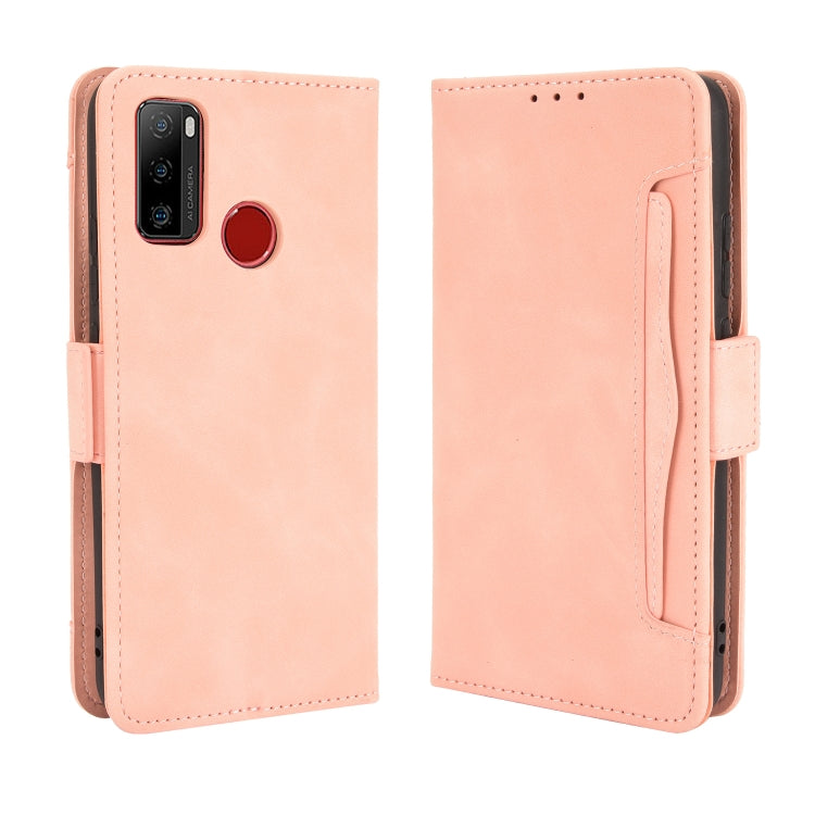 For Ulefone Note 10 Skin Feel Calf Pattern Horizontal Flip Leather Case with Holder & Card Slots & Photo Frame(Pink)