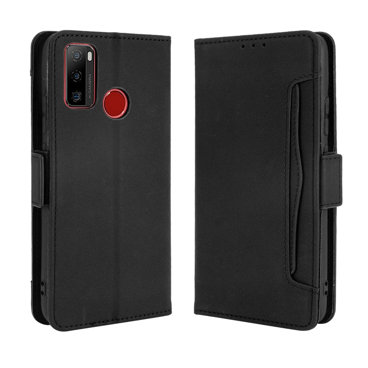 For Ulefone Note 10 Skin Feel Calf Pattern Horizontal Flip Leather Case with Holder & Card Slots & Photo Frame(Black)