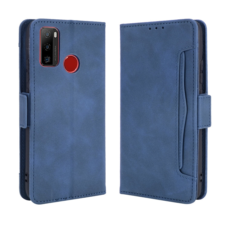 For Ulefone Note 10 Skin Feel Calf Pattern Horizontal Flip Leather Case with Holder & Card Slots & Photo Frame(Blue)