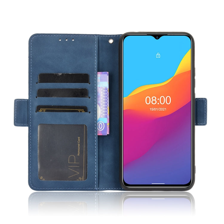 For Ulefone Note 10 Skin Feel Calf Pattern Horizontal Flip Leather Case with Holder & Card Slots & Photo Frame(Blue)