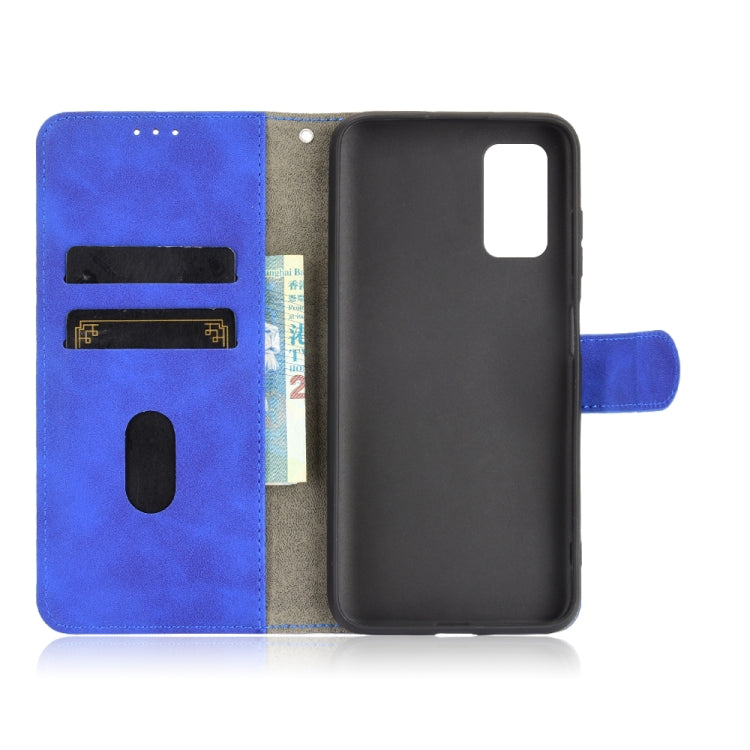 For Blackview A90 Solid Color Skin Feel Magnetic Buckle Horizontal Flip Calf Texture PU Leather Case with Holder & Card Slots & Wallet(Blue)