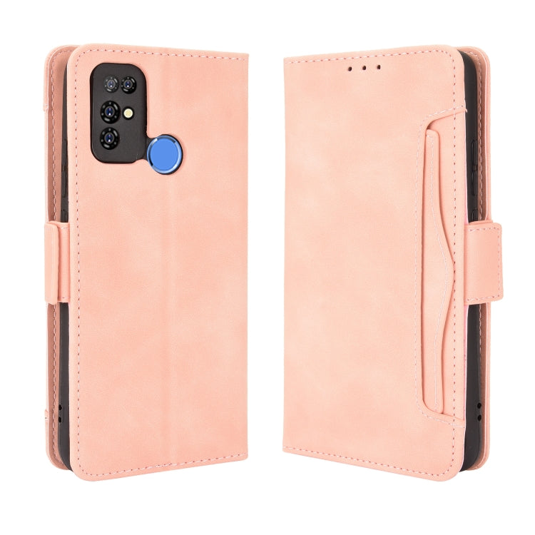 For Doogee X96 Pro Skin Feel Calf Pattern Horizontal Flip Leather Case with Holder & Card Slots & Photo Frame(Pink)