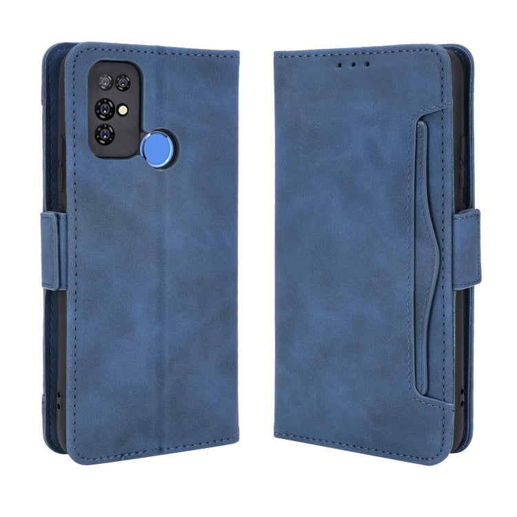 For Doogee X96 Pro Skin Feel Calf Pattern Horizontal Flip Leather Case with Holder & Card Slots & Photo Frame(Blue)