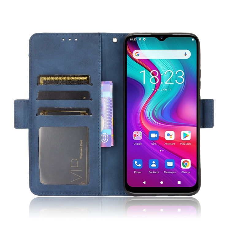 For Doogee X96 Pro Skin Feel Calf Pattern Horizontal Flip Leather Case with Holder & Card Slots & Photo Frame(Blue)
