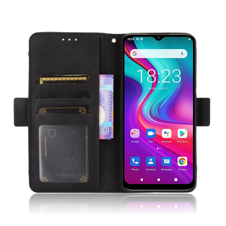 For Doogee X96 Pro Skin Feel Calf Pattern Horizontal Flip Leather Case with Holder & Card Slots & Photo Frame(Black)