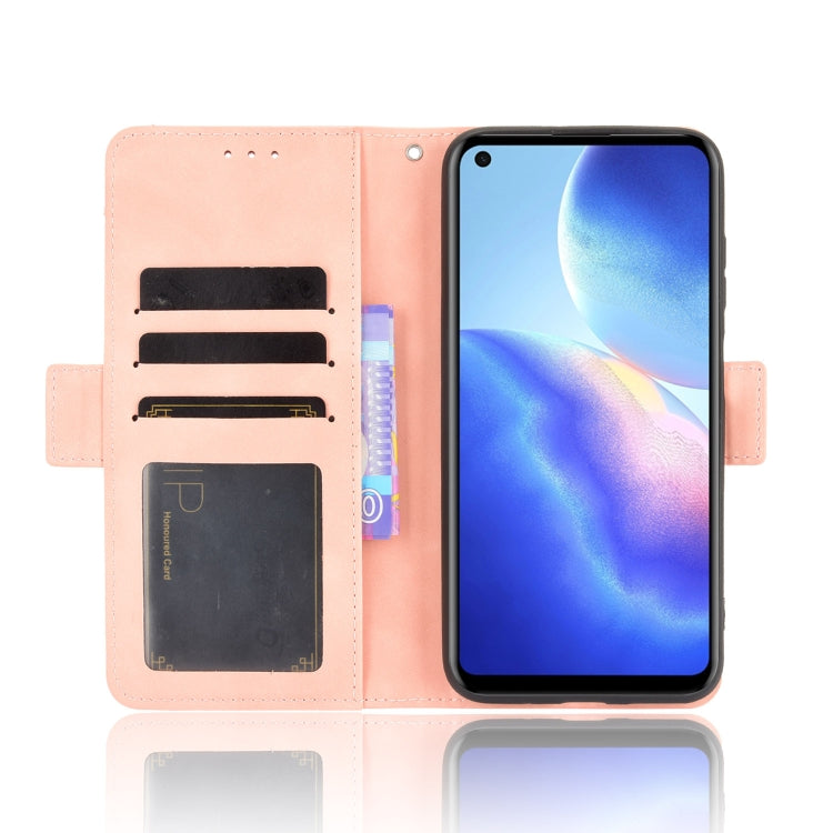 For Blackview A90 Skin Feel Calf Pattern Horizontal Flip Leather Case with Holder & Card Slots & Photo Frame(Pink)