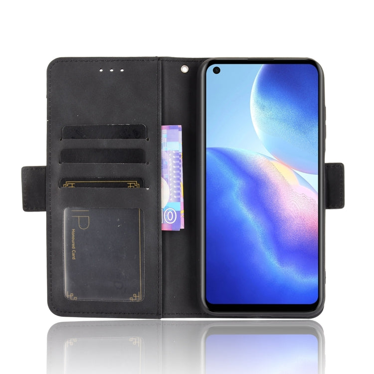 For Blackview A90 Skin Feel Calf Pattern Horizontal Flip Leather Case with Holder & Card Slots & Photo Frame(Black)