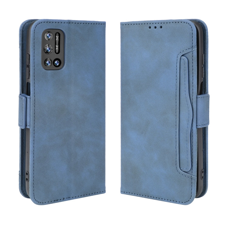 For Doogee N40 Pro Skin Feel Calf Pattern Horizontal Flip Leather Case with Holder & Card Slots & Photo Frame(Blue)