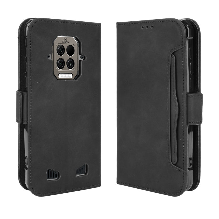 For Doogee S86 / S86 Pro Skin Feel Calf Pattern Horizontal Flip Leather Case with Holder & Card Slots & Photo Frame(Black)