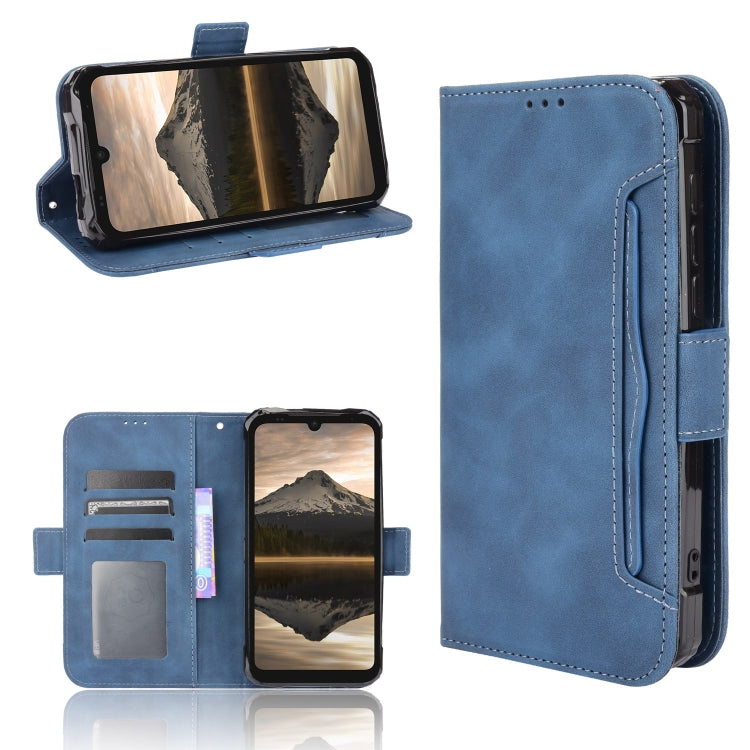 For Doogee S86 / S86 Pro Skin Feel Calf Pattern Horizontal Flip Leather Case with Holder & Card Slots & Photo Frame(Blue)