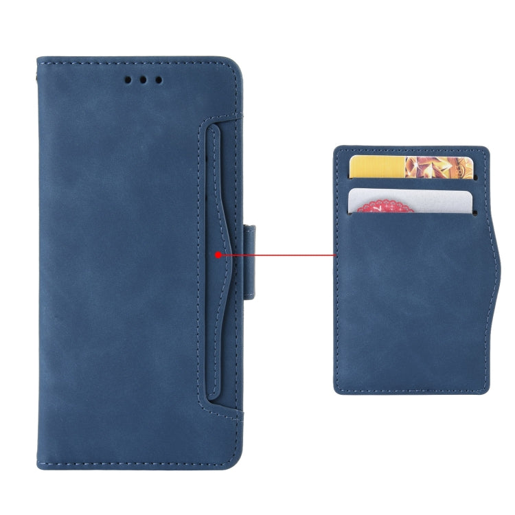 For Doogee S96 Pro Skin Feel Calf Pattern Leather Phone Case(Blue)