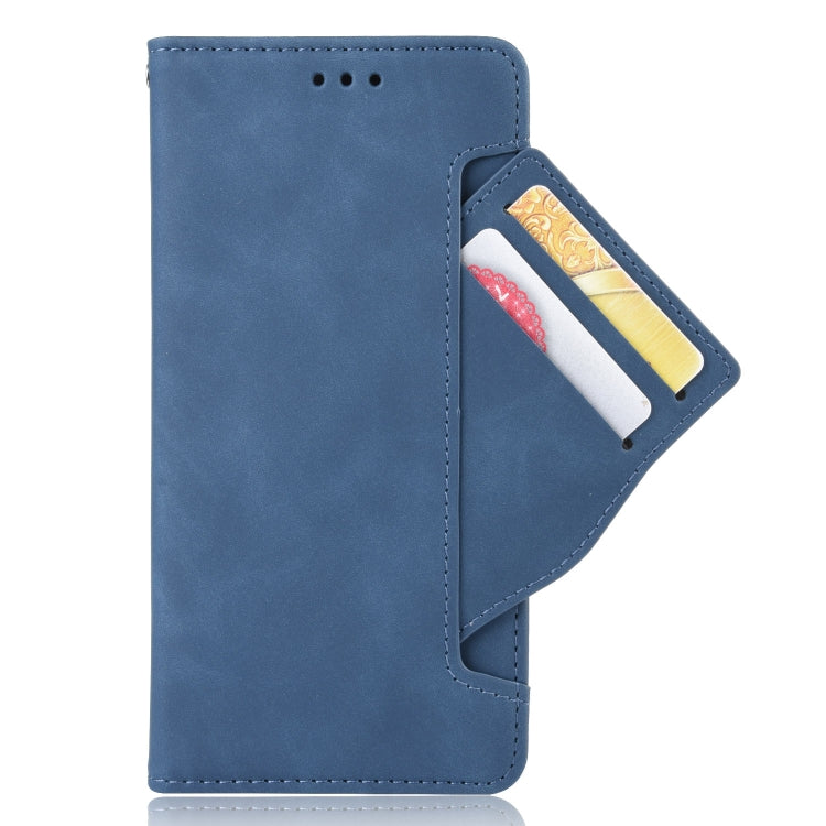 For Blackview A55 Skin Feel Calf Pattern Leather Phone Case(Blue)