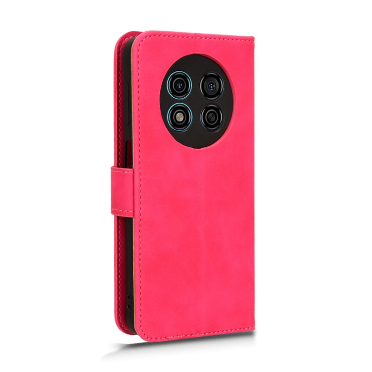 For Ulefone Note 15 Skin Feel Magnetic Flip Leather Phone Case(Rose Red)