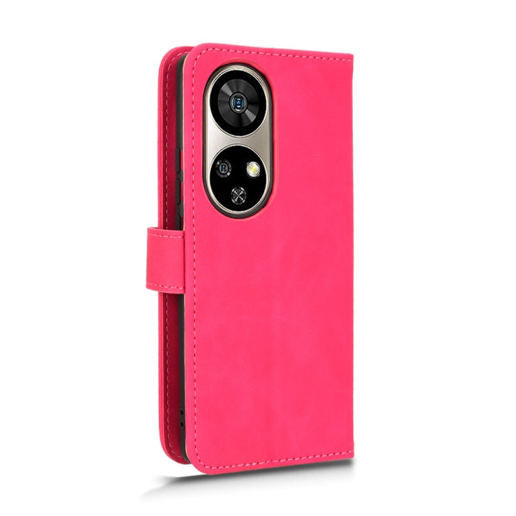 For Ulefone Note 17 Pro Skin Feel Magnetic Flip Leather Phone Case(Rose Red)