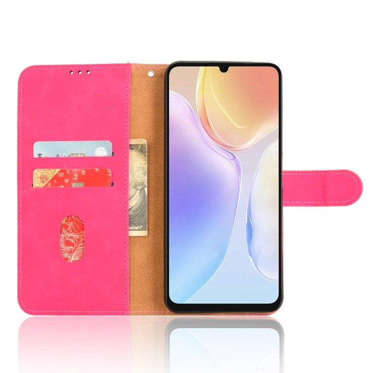 For Ulefone Note 20 Pro Skin Feel Magnetic Flip Leather Phone Case(Rose Red)