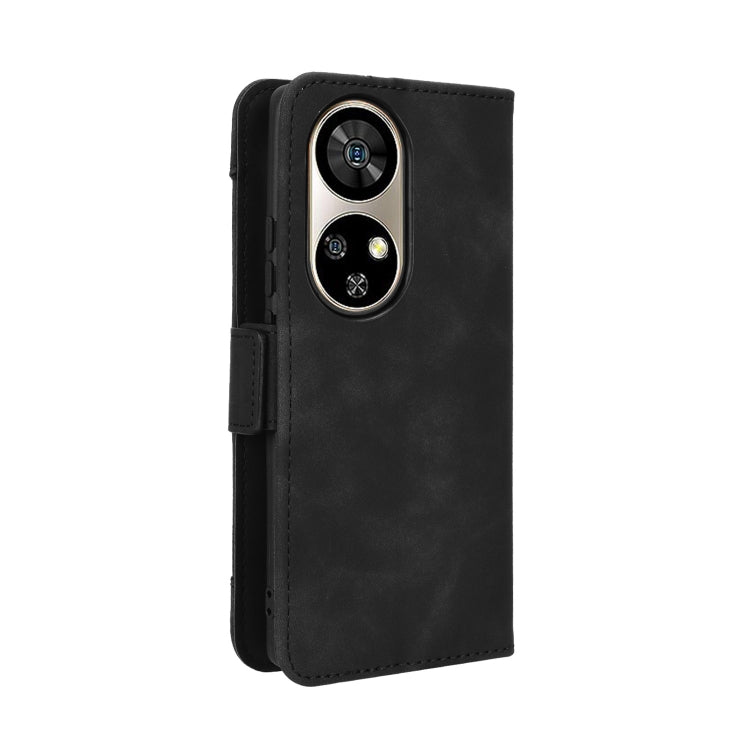 For Ulefone Note 17 Pro Skin Feel Calf Texture Card Slots Leather Phone Case(Black)