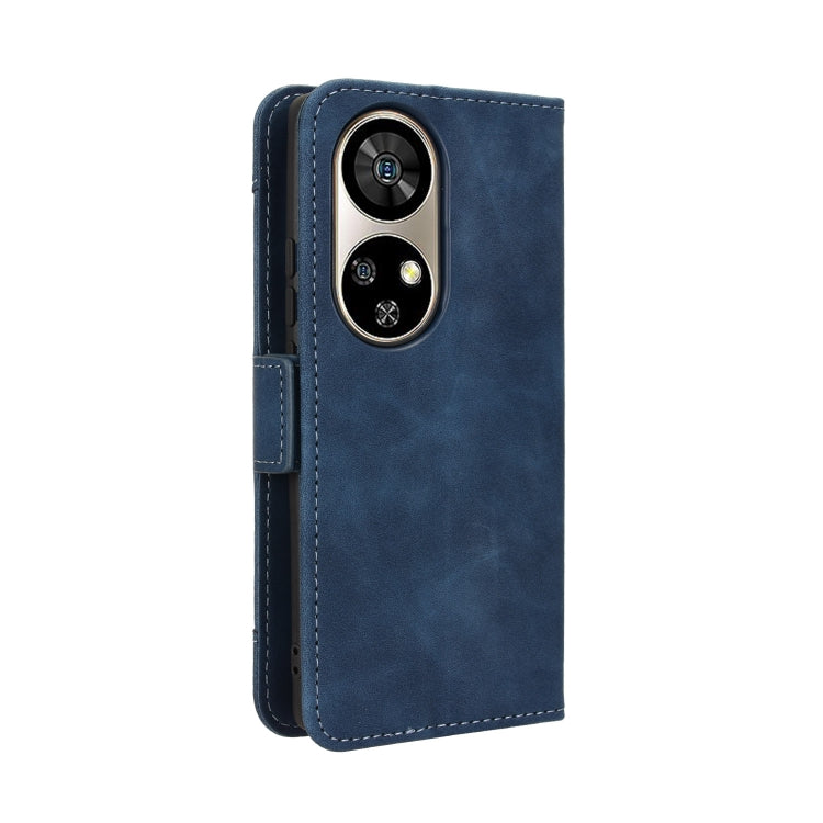 For Ulefone Note 17 Pro Skin Feel Calf Texture Card Slots Leather Phone Case(Blue)