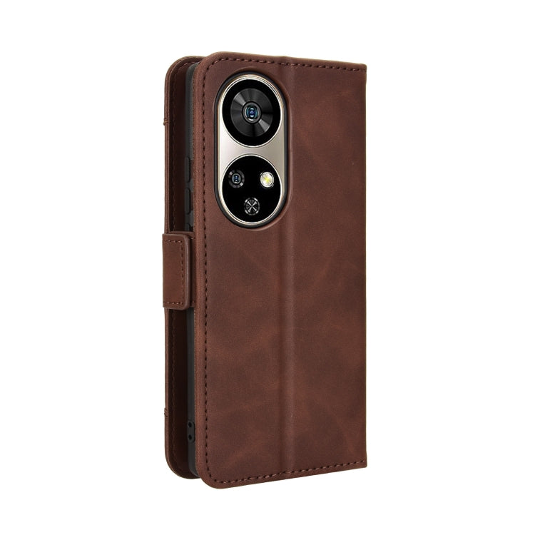 For Ulefone Note 17 Pro Skin Feel Calf Texture Card Slots Leather Phone Case(Brown)