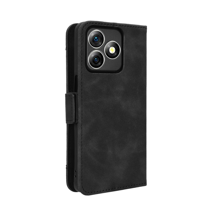 For Ulefone Note 18 Ultra Skin Feel Calf Texture Card Slots Leather Phone Case(Black)