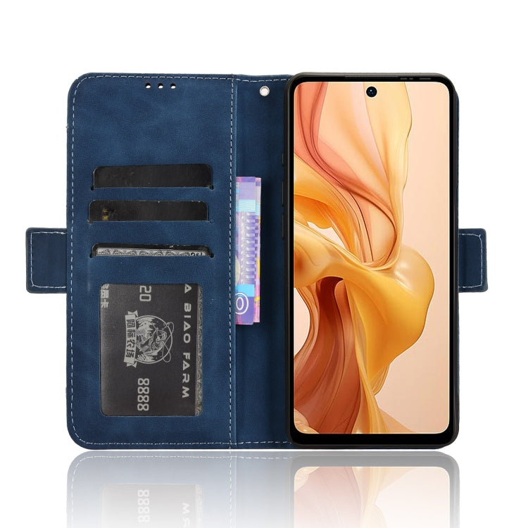 For Ulefone Note 18 Ultra Skin Feel Calf Texture Card Slots Leather Phone Case(Blue)