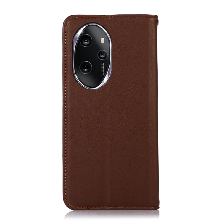 For Honor 100 Pro KHAZNEH Nappa Top Layer Cowhide Leather Phone Case(Brown)