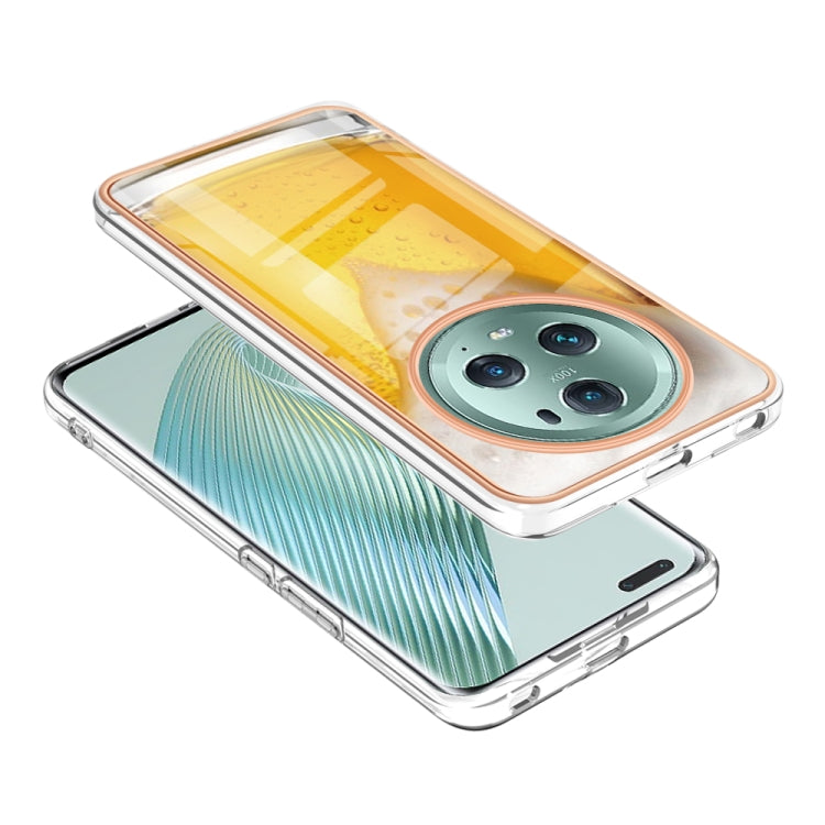 For Honor Magic 5 Pro Electroplating Marble Dual-side IMD Phone Case(Draft Beer)