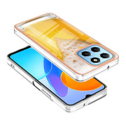 For Honor X8 5G / X6 4G Electroplating Marble Dual-side IMD Phone Case(Draft Beer)