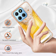 For Honor X8 5G / X6 4G Electroplating Marble Dual-side IMD Phone Case(Draft Beer)