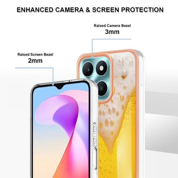 For Honor X6a Electroplating Marble Dual-side IMD Phone Case(Draft Beer)