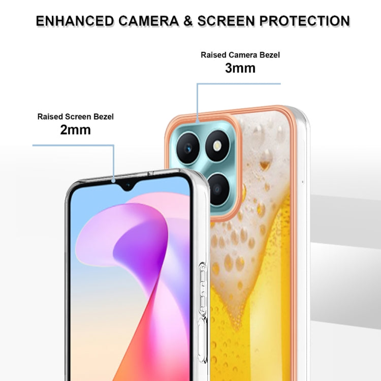 For Honor X6a Electroplating Marble Dual-side IMD Phone Case(Draft Beer)