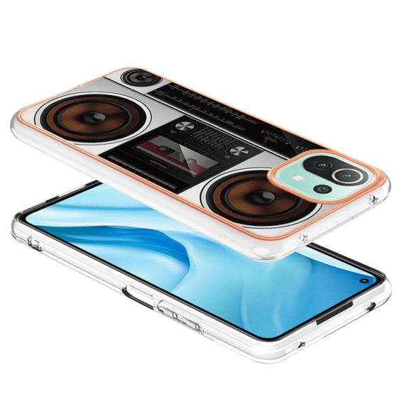 For Xiaomi 11 Lite Electroplating Marble Dual-side IMD Phone Case(Retro Radio)