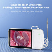 C02 Visible Ear Spoon with 4.5 inch Sreen