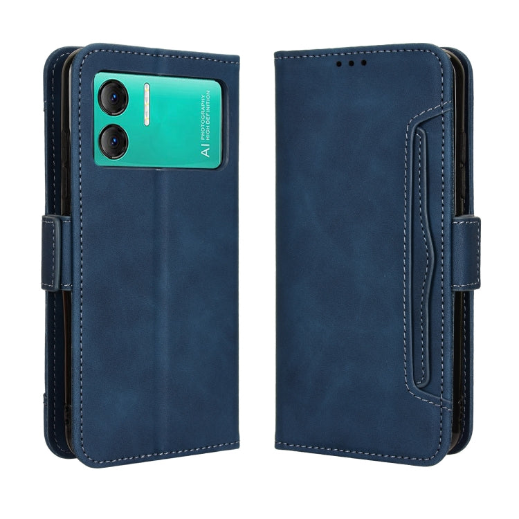 For Doogee X98 Skin Feel Calf Texture Card Slots Leather Phone Case(Blue)
