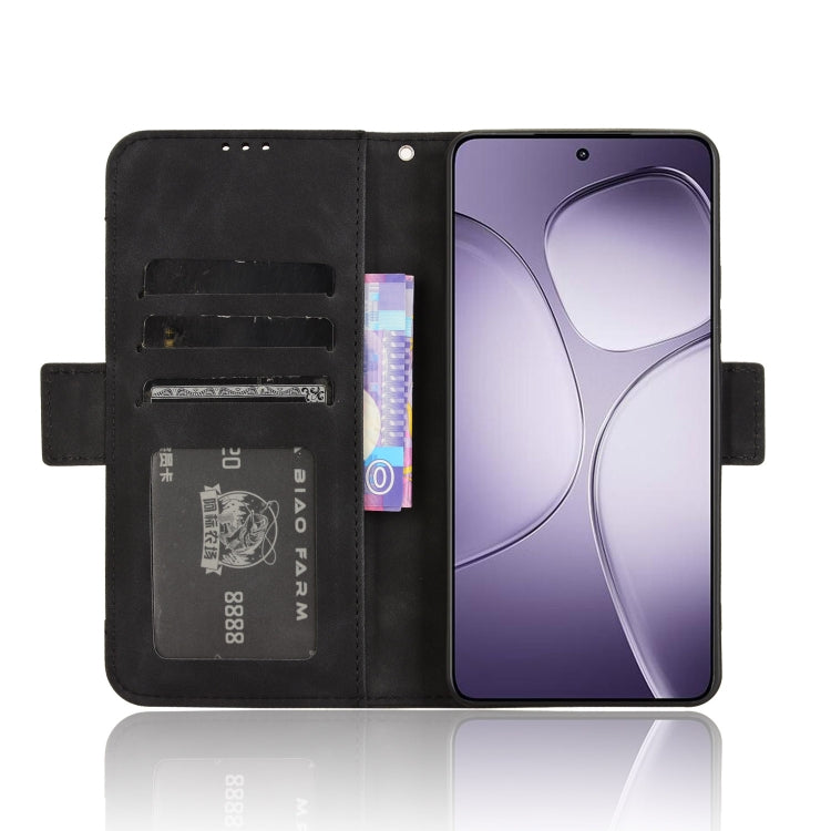For Redmi K70 Ultra Skin Feel Calf Texture Card Slots Leather Phone Case(Black)