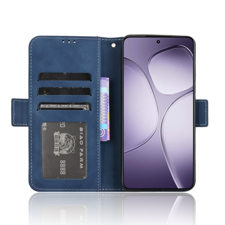For Redmi K70 Ultra Skin Feel Calf Texture Card Slots Leather Phone Case(Blue)