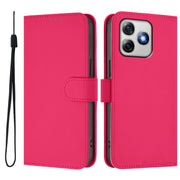 For Ulefone Note 18 Ultra Skin Feel Solid Color Leather Phone Case with Lanyard(Rose Red)
