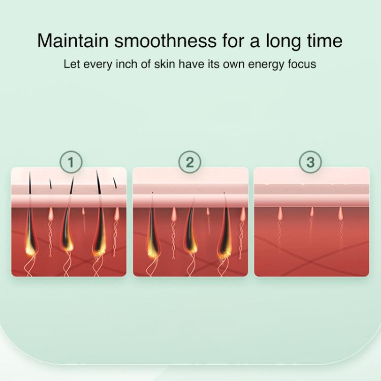 FY-B503 Portable Laser Hair Removal Device Photon Electric IPL Intense Pulse Hair Remover, EU Plug(White)