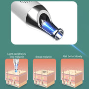 AA-A401 Portable Laser Beauty Instrument Mole Removal Freckle Removal Beauty Laser Pen, Specification:Blue Light Plug-in
