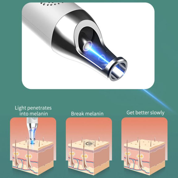 AA-A401 Portable Laser Beauty Instrument Mole Removal Freckle Removal Beauty Laser Pen, Specification:Blue Light Plug-in