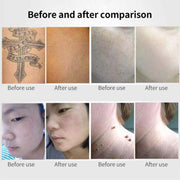 AA-A401 Portable Laser Beauty Instrument Mole Removal Freckle Removal Beauty Laser Pen, Specification:Red Light Plug-in