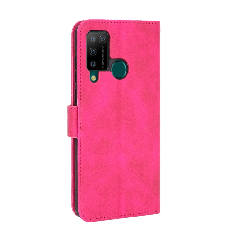 For DOOGEE N20 Pro Solid Color Skin Feel Magnetic Buckle Horizontal Flip Calf Texture PU Leather Case with Holder & Card Slots & Wallet(Rose Red)