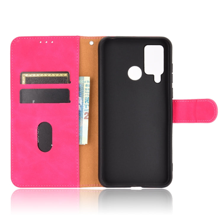 For DOOGEE N20 Pro Solid Color Skin Feel Magnetic Buckle Horizontal Flip Calf Texture PU Leather Case with Holder & Card Slots & Wallet(Rose Red)