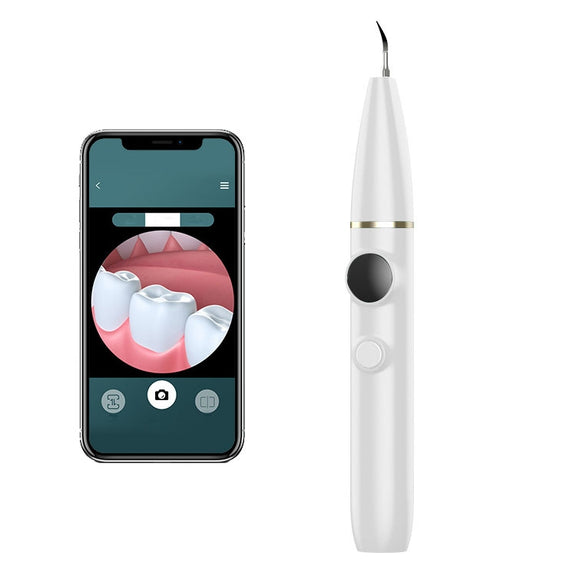 Tartar and Calculus Remover Oral Cleaning Ultrasonic Scaler Electric Visual Scaler(White)
