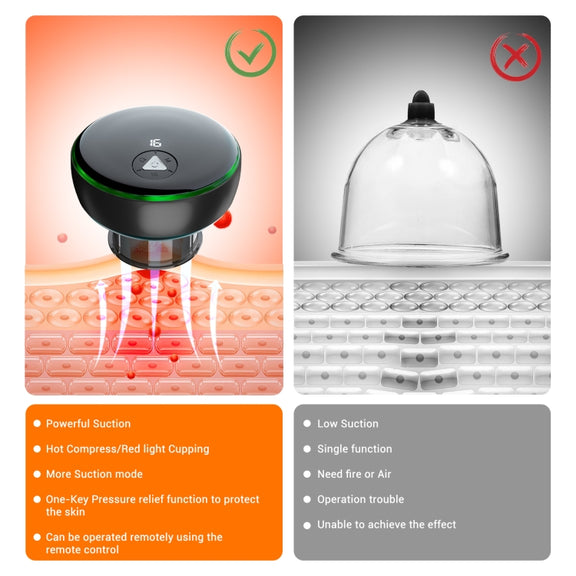 Intelligent Cupper With Breathing Light Electric Heated Scraping Instrument Meridian Unblocking Massage Instrument(Black)