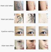 Laser Tattoo Removal Machine Non-invasive Eyebrow Washing Beauty Equipment(EU Plug)