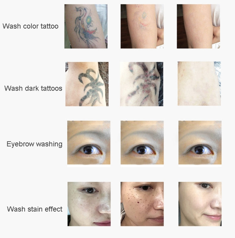 Laser Tattoo Removal Machine Non-invasive Eyebrow Washing Beauty Equipment(EU Plug)