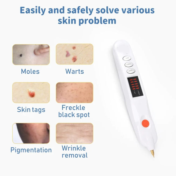 Spot Mole Pen Spot Removal Instrument Home Beauty Instrument, Spec: Plug-in Model EU(Golden)