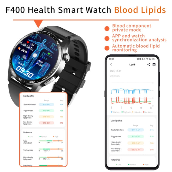 F400  1.55 Inch Screen Smart Watch Support ECG/ Blood Oxygen / Blood Sugar / 150+ Sports Mode, Color: Black Leather
